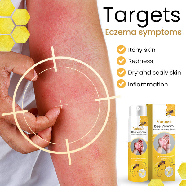 🏆✅FDA Endorsed🇺🇸 |🐝Vuitoze™ Bee Venom Eczema Treatment Spray