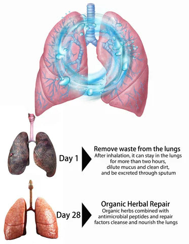 🔥2024 HOT SALE🔥AEXZR™ Organic Herbal Lung Cleanse Repair Nasal Spray