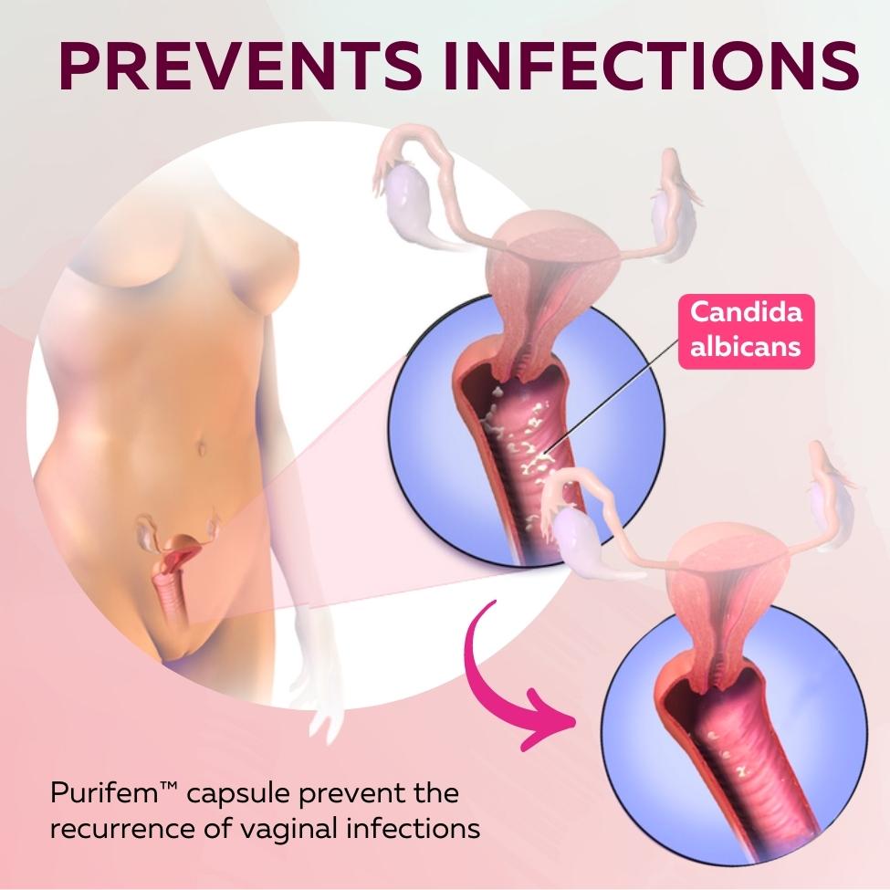 Purifem™ Feminine Care Capsules