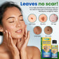 AEXZR™ Skin Spot Removal Serum